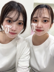 【虫歯になりやすい歯・なりにくい歯】