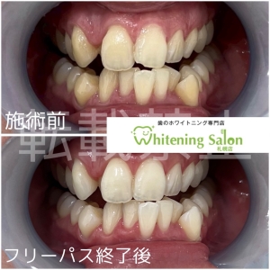 【唾液の分泌量を増やすには】