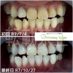 【口が臭い、臭くない人の違い】大通り/ホワイトニング